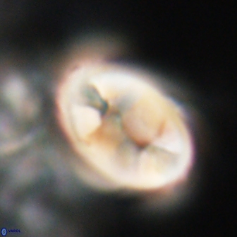 Neocrepidolithus opertus 21517