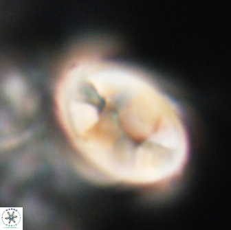 Neocrepidolithus opertus 21517