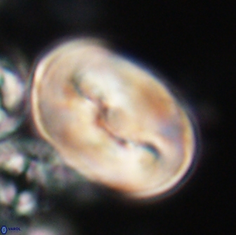 Neocrepidolithus opertus 21520