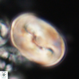 Neocrepidolithus opertus 21520