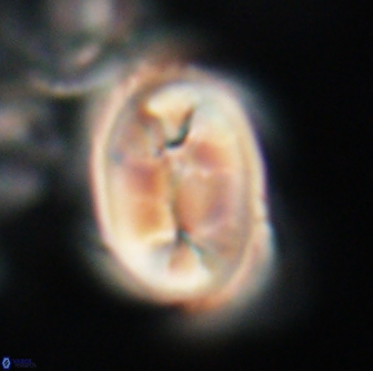 Neocrepidolithus opertus 21522