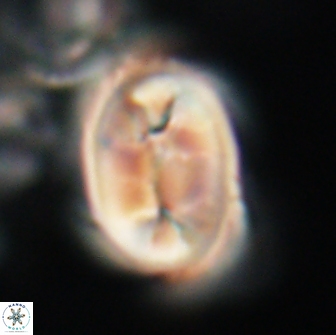Neocrepidolithus opertus 21522