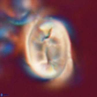 Neocrepidolithus opertus 21523