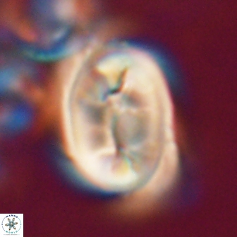 Neocrepidolithus opertus 21523