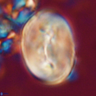 Neocrepidolithus opertus 21525