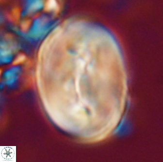 Neocrepidolithus opertus 21525