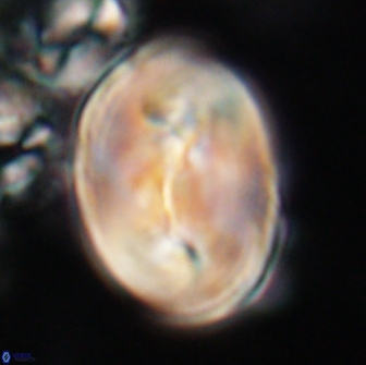 Neocrepidolithus opertus 21526