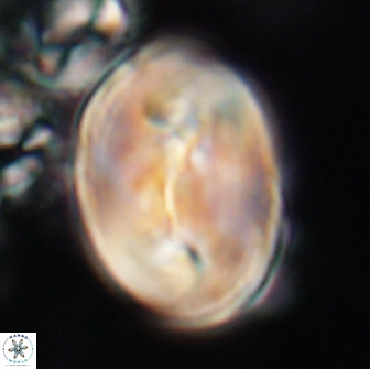 Neocrepidolithus opertus 21526