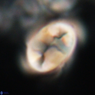 Neocrepidolithus opertus 21527