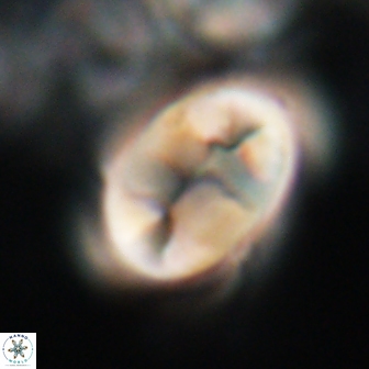 Neocrepidolithus opertus 21527