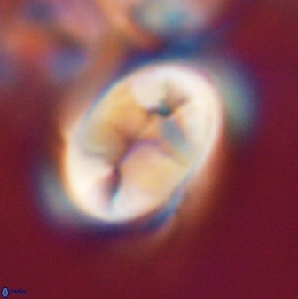 Neocrepidolithus opertus 21528