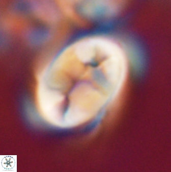 Neocrepidolithus opertus 21528