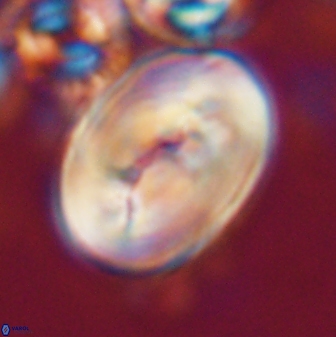 Neocrepidolithus opertus 21529