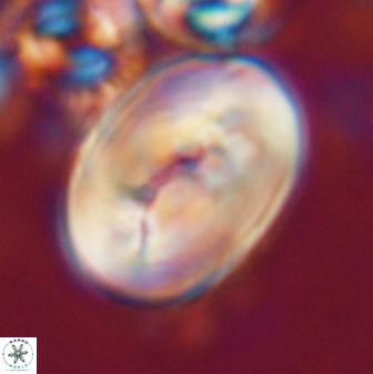 Neocrepidolithus opertus 21529