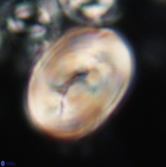 Neocrepidolithus opertus 21530