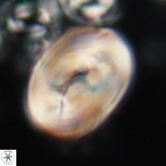 Neocrepidolithus opertus 21530