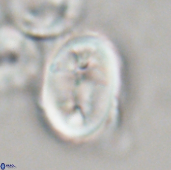 Neocrepidolithus opertus 21532