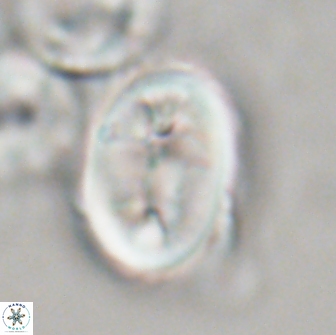Neocrepidolithus opertus 21532