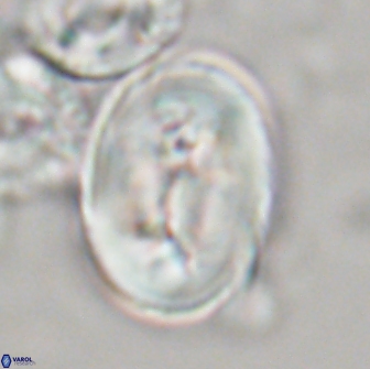 Neocrepidolithus opertus 21533