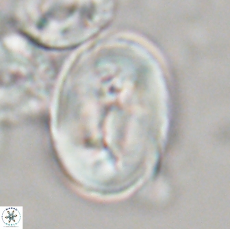 Neocrepidolithus opertus 21533