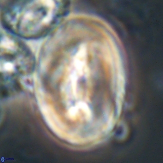 Neocrepidolithus opertus 21535
