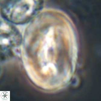 Neocrepidolithus opertus 21535