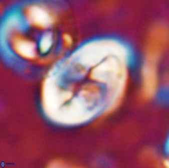 Neocrepidolithus opertus 22521