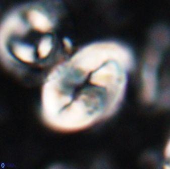 Neocrepidolithus opertus 22522