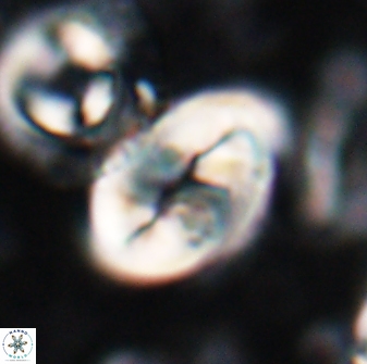 Neocrepidolithus opertus 22522