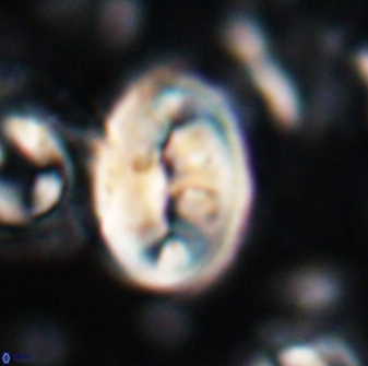 Neocrepidolithus opertus 22523