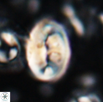 Neocrepidolithus opertus 22523