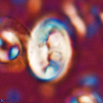 Neocrepidolithus opertus 22524