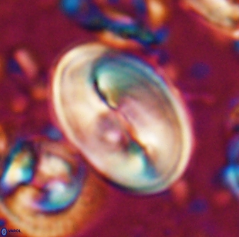 Neocrepidolithus opertus 22525