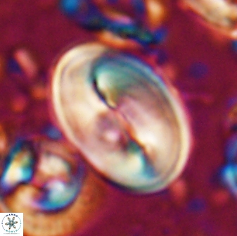Neocrepidolithus opertus 22525