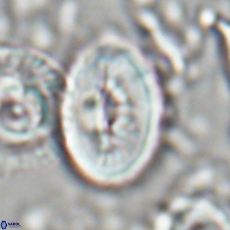 Neocrepidolithus opertus 22526
