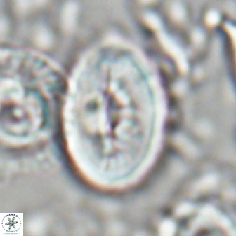Neocrepidolithus opertus 22526