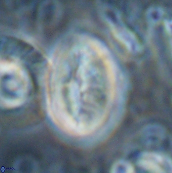 Neocrepidolithus opertus 22527