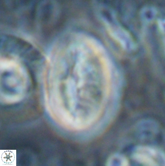 Neocrepidolithus opertus 22527
