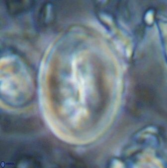 Neocrepidolithus opertus 22528