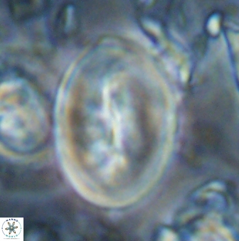 Neocrepidolithus opertus 22528