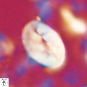 Neocrepidolithus opertus 22251