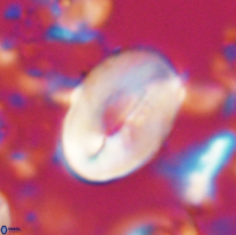 Neocrepidolithus opertus 22255