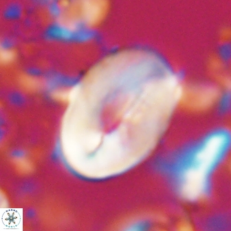 Neocrepidolithus opertus 22255