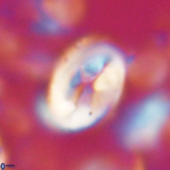 Neocrepidolithus opertus 22256