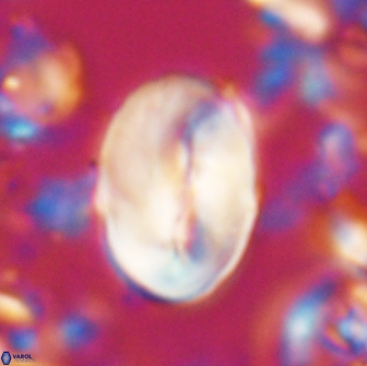 Neocrepidolithus opertus 22259