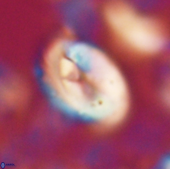 Neocrepidolithus opertus 22265