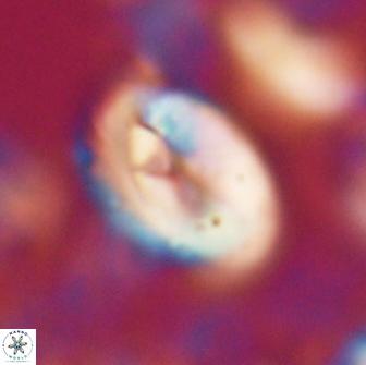 Neocrepidolithus opertus 22265