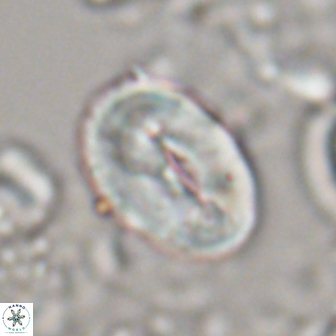 Neocrepidolithus opertus 22266