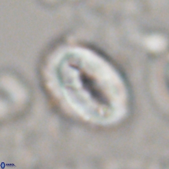 Neocrepidolithus opertus 22267