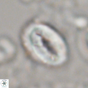Neocrepidolithus opertus 22267